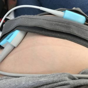 Monitores durante el parto